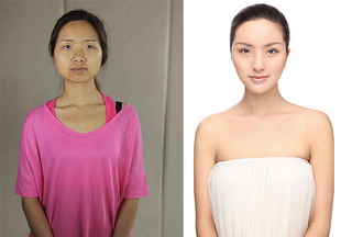 Illustration for article titled Intense Photos of Plastic Surgery Tranformations Going Viral in China